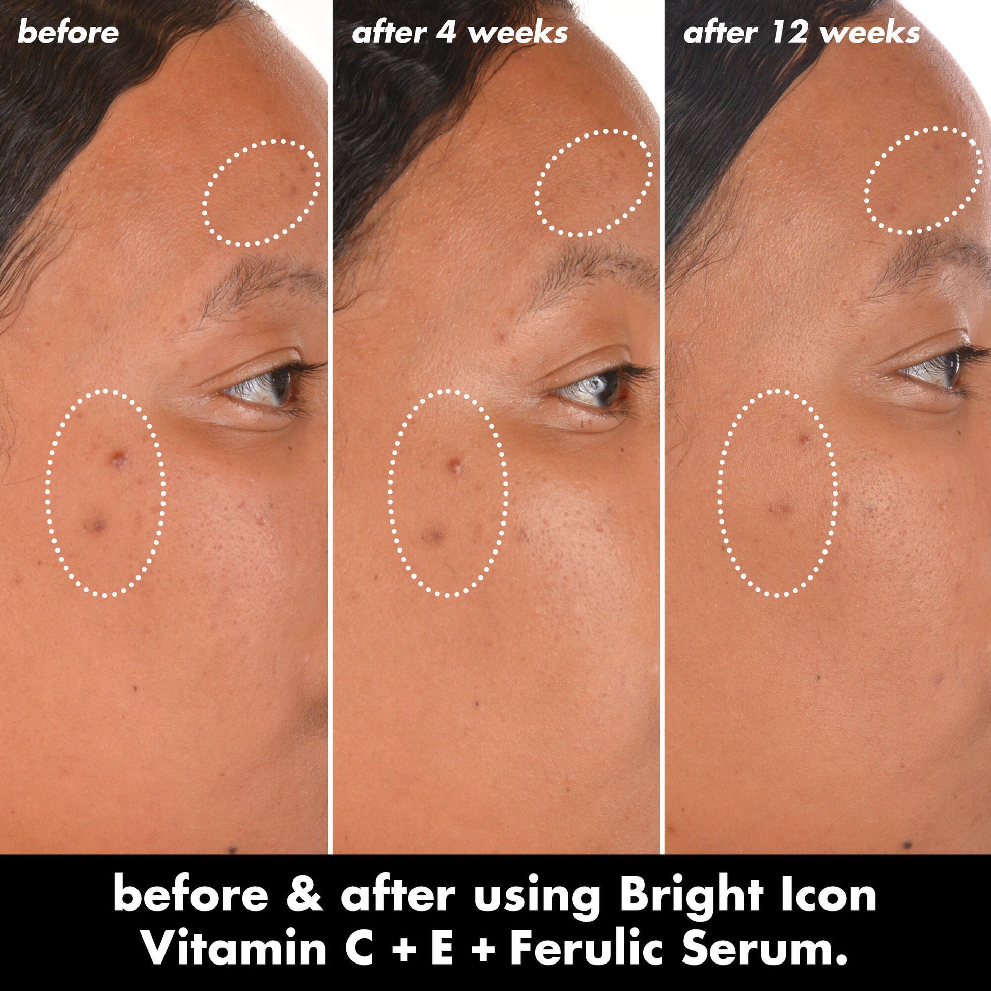 bright-icon-vitamin-c-e-ferulic-serum-t1 0226_EDU_BrightIconVitC_BA_Chanel_TRIPTYCH_c58f2fc8-209d-414f-9ba3-666a07a94887.jpg