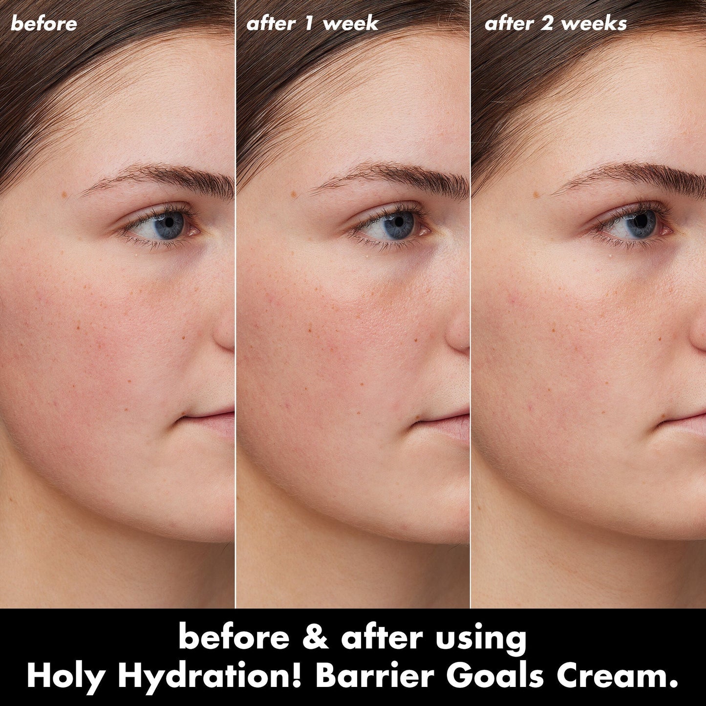 holy-hydration-barrier-goals-cream-mini-m4 0226_EDU_HHBarrierGoalsCream_B_A_Zoe_TRYPTICH_4f0e5b5d-35fb-4020-968e-244d4536afbd.jpg