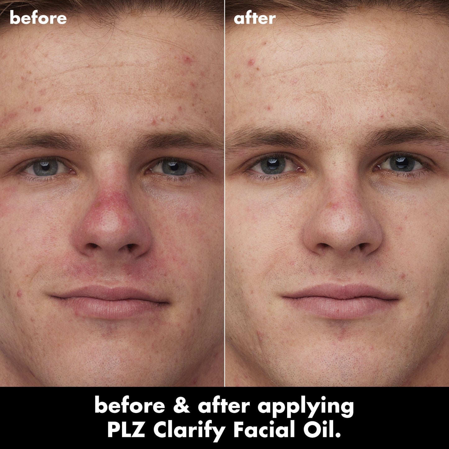 plz-clarify-facial-oil-q6 0326_EDU_PlzClarify_BA_Caleb.jpg