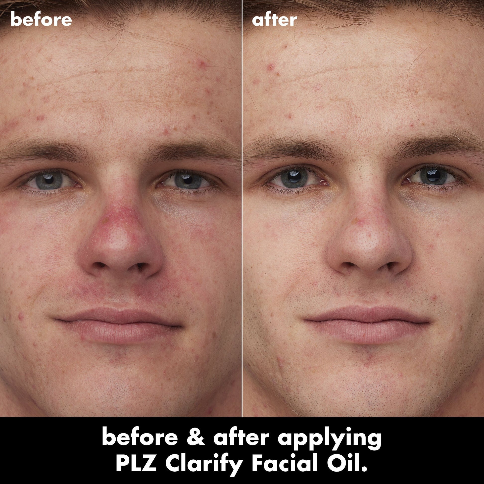 plz-clarify-facial-oil-q6 0326_EDU_PlzClarify_BA_Caleb.jpg
