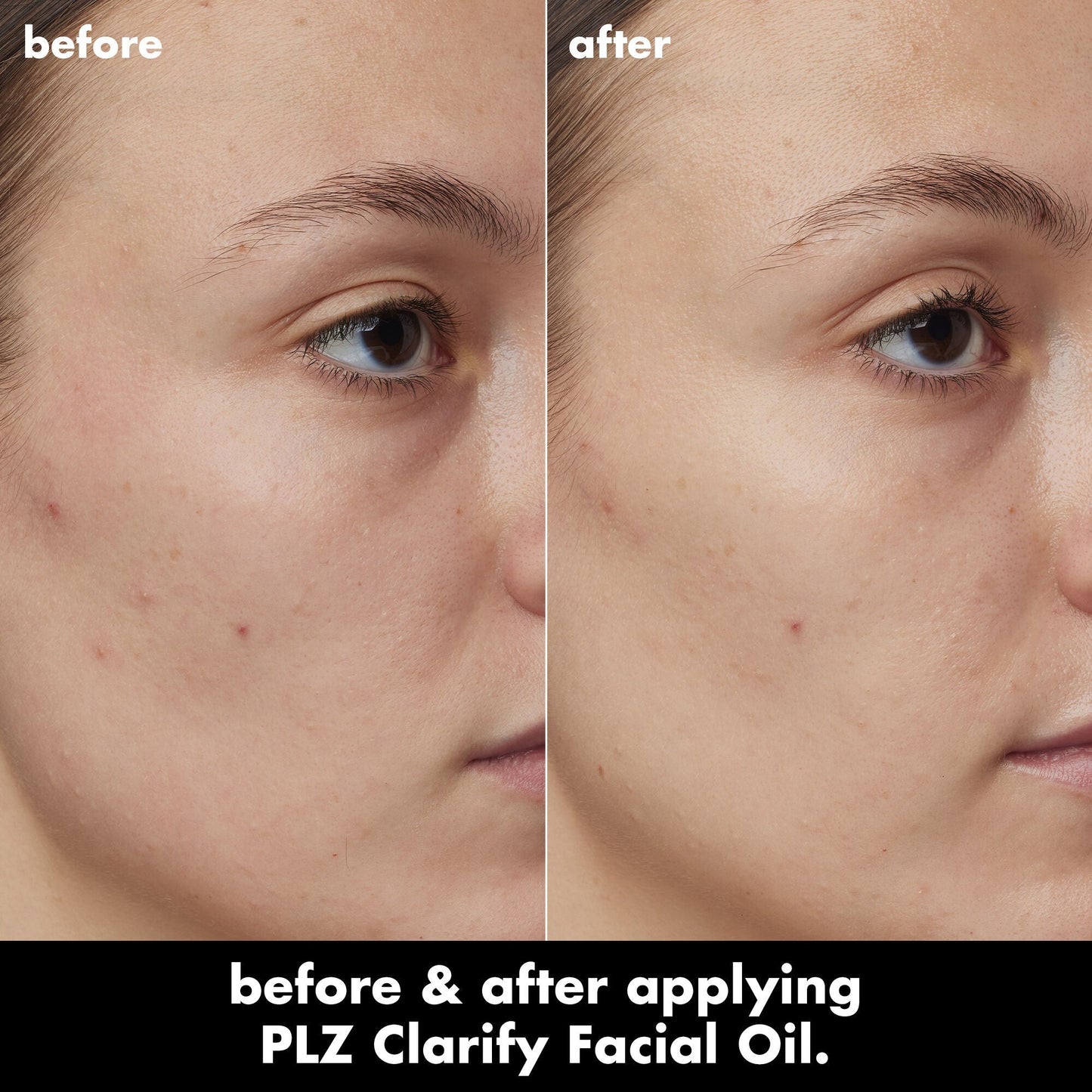 plz-clarify-facial-oil-q6 0326_EDU_PlzClarify_BA_Kelly.jpg