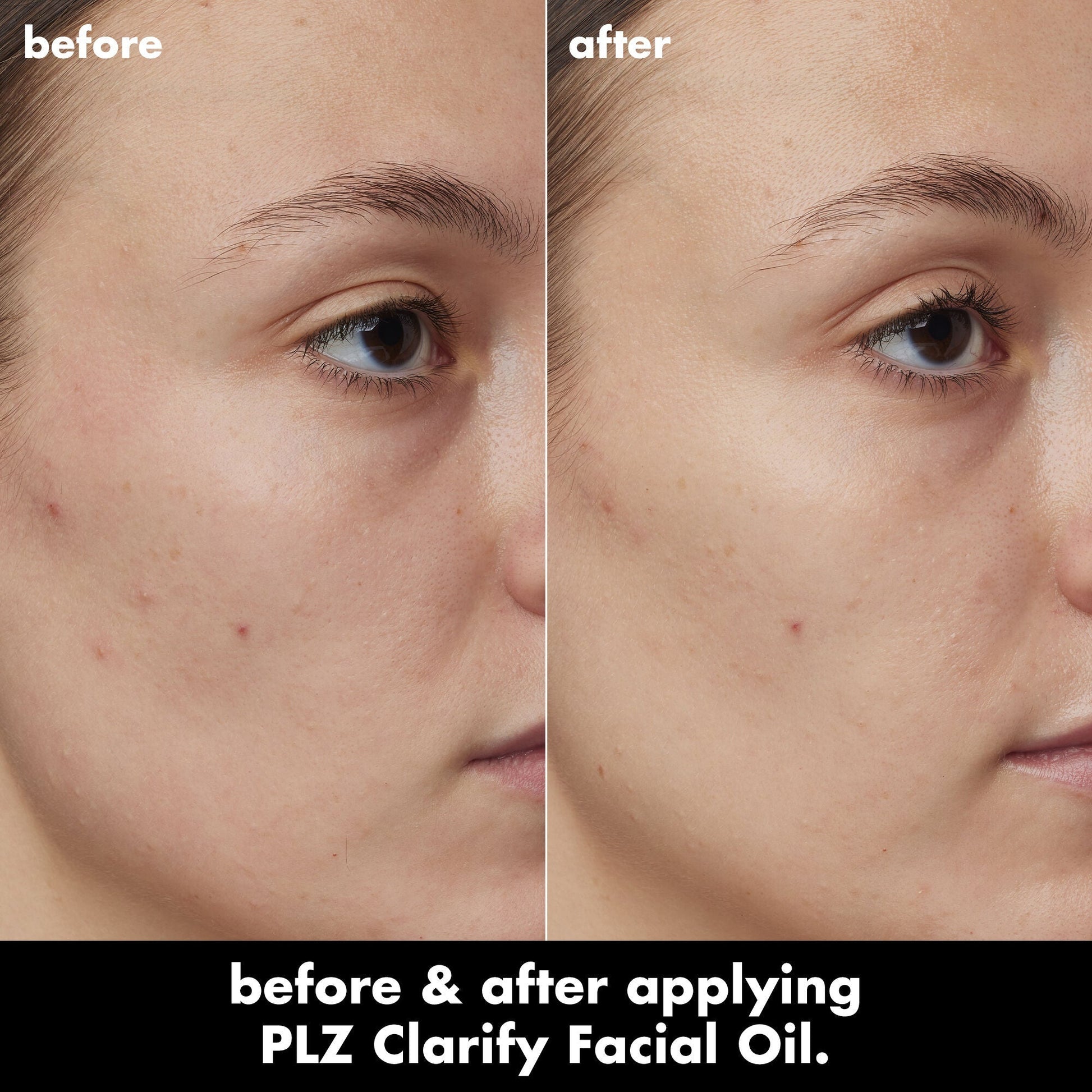 plz-clarify-facial-oil-q6 0326_EDU_PlzClarify_BA_Kelly.jpg