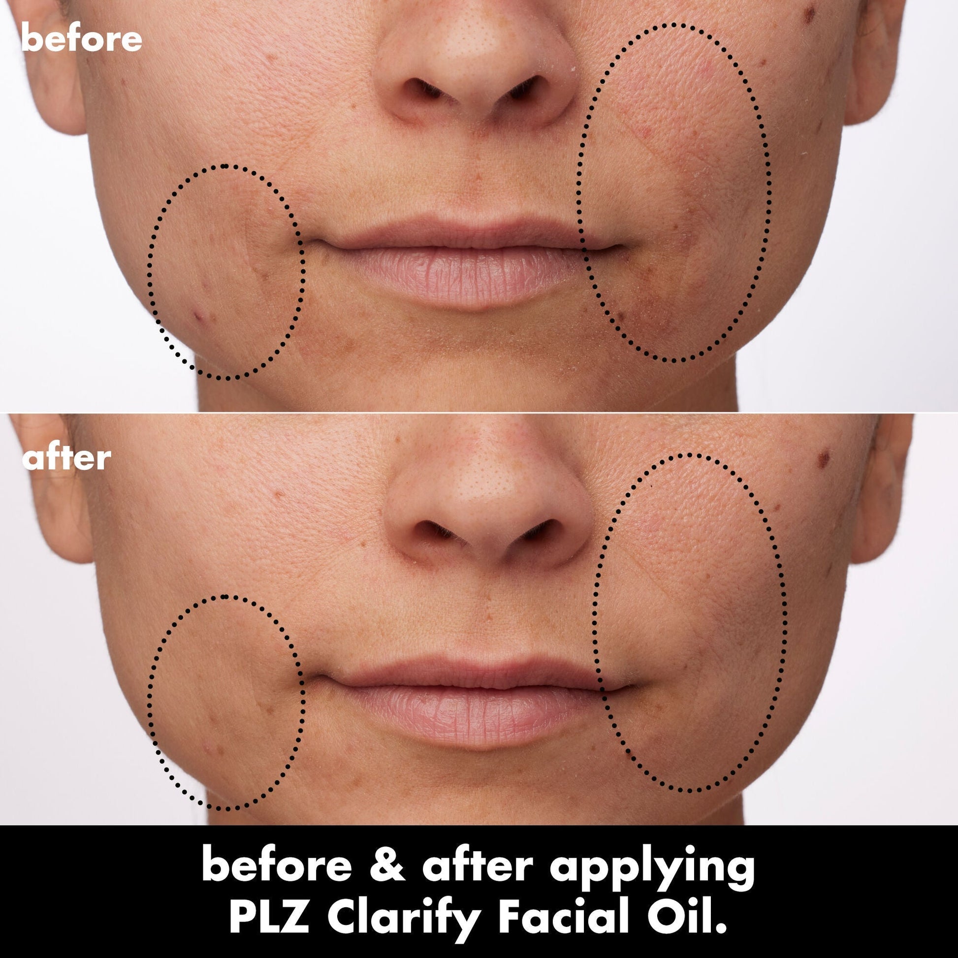 plz-clarify-facial-oil-q6 0326_EDU_PlzClarify_BA_Paula.jpg