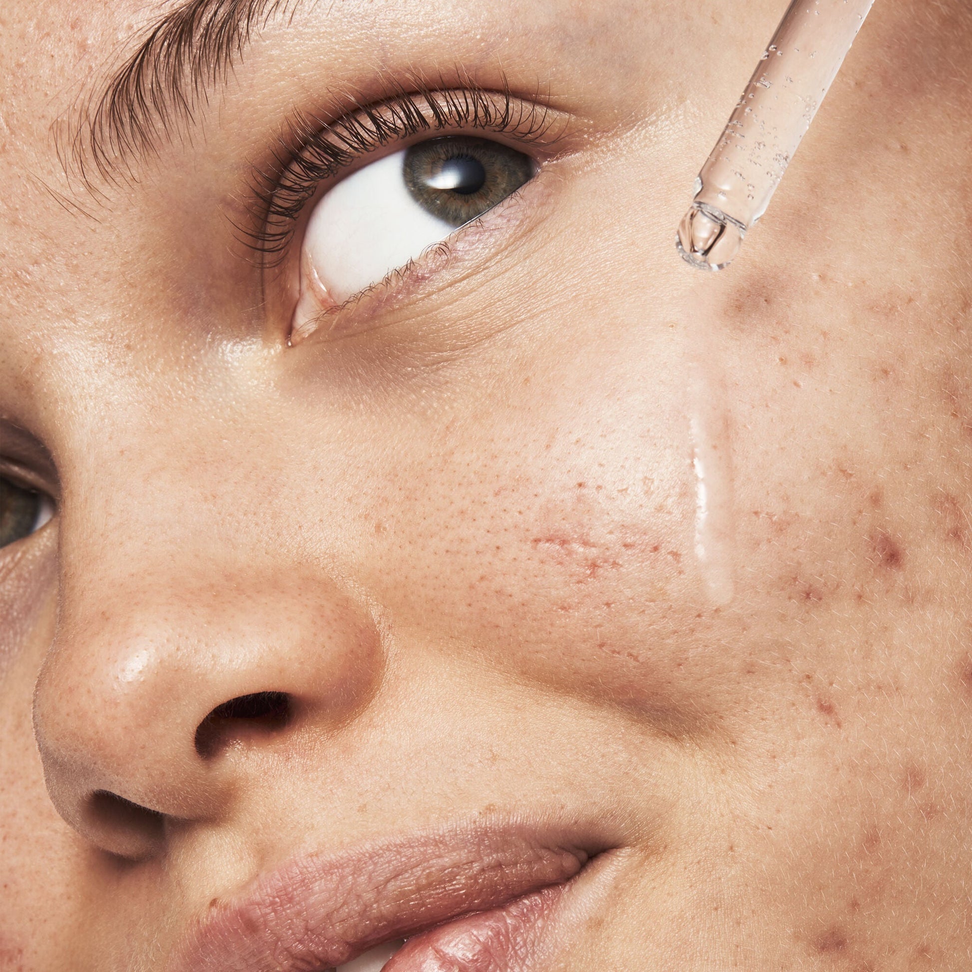 blemish-breakthrough-triple-acid-resurfacing-serum-y7 121321_Marley-Acne-Regimen_0254_FINAL_IGF.jpg