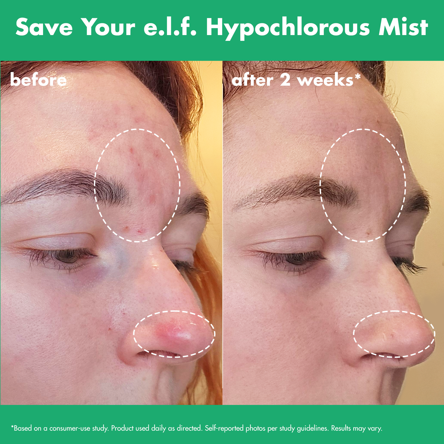 save-your-e-l-f-hypochlorous-mist-e6 FA26_EDUCATION_SAVEYOURELF_USAGE_BA1_WITHOUT_CLAIMS.png