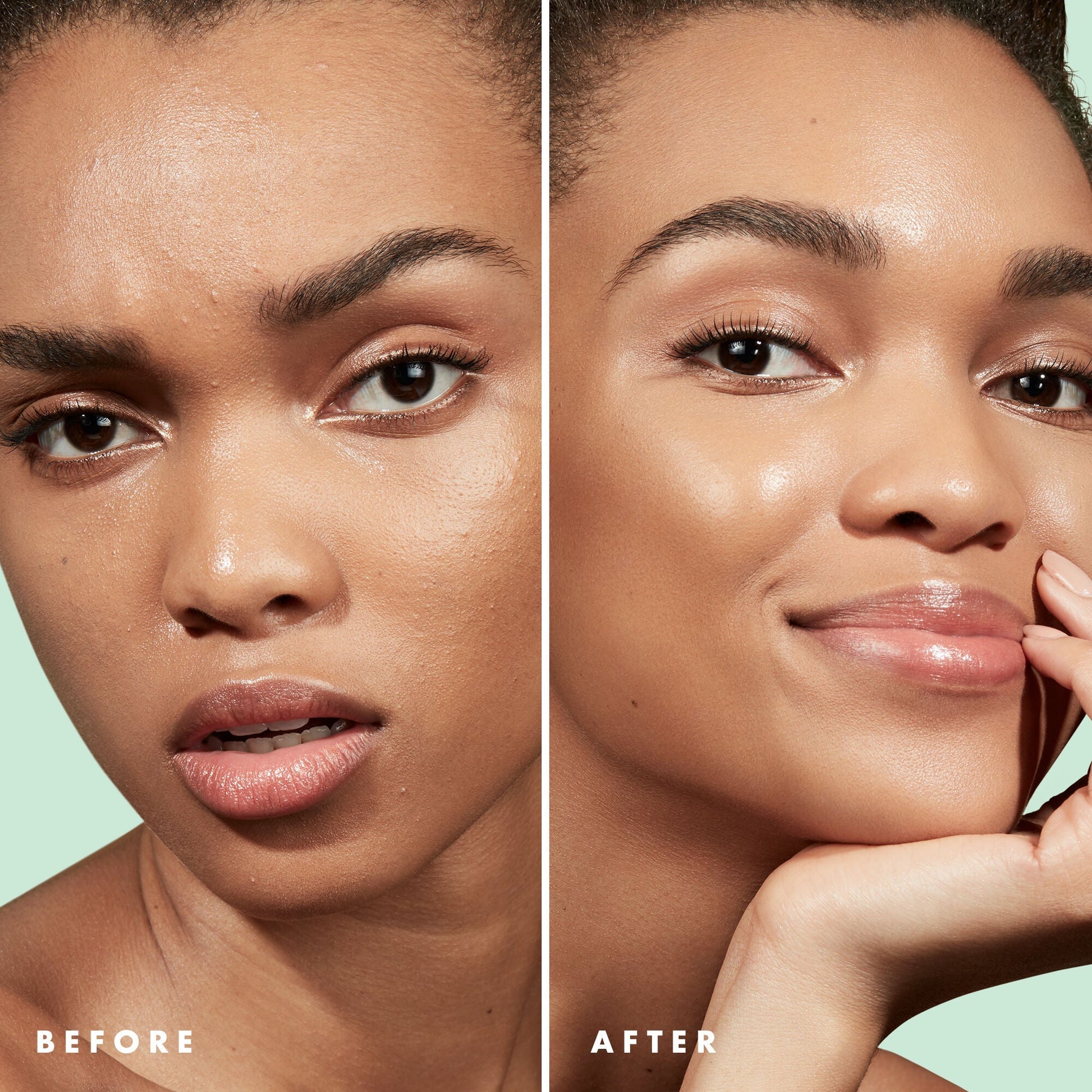 blemish-control-face-primer-large-size-g5 Primer_PP_Before_After_BlemishControl_2000x2000_3774231e-d4e1-49dd-b3d7-a73cbac901fe.jpg
